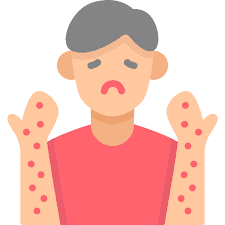 Rashes in Skin