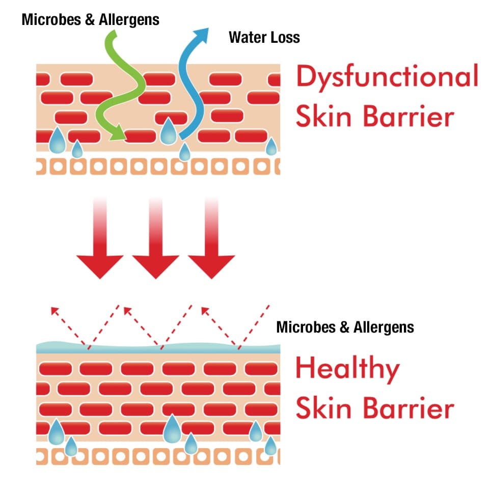 Weakened Skin Barrier