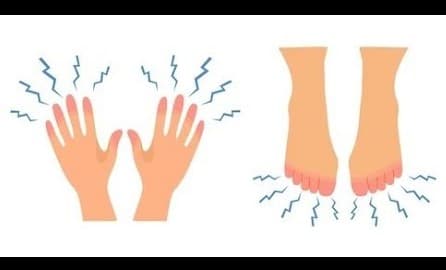 Numbness or Tingling