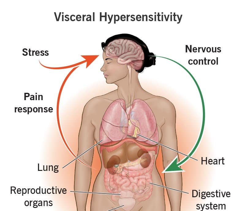 Visceral Hypersensitivity