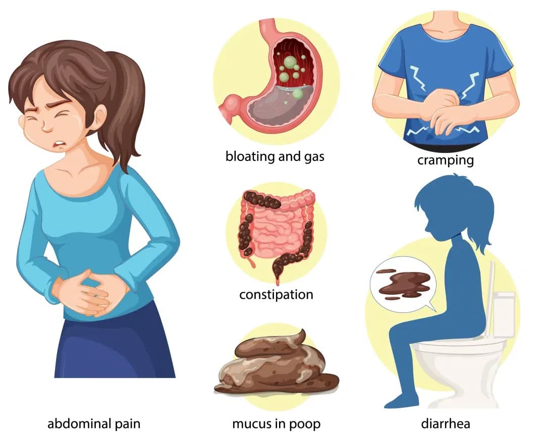 IBS (Irritable Bowel Syndrome)