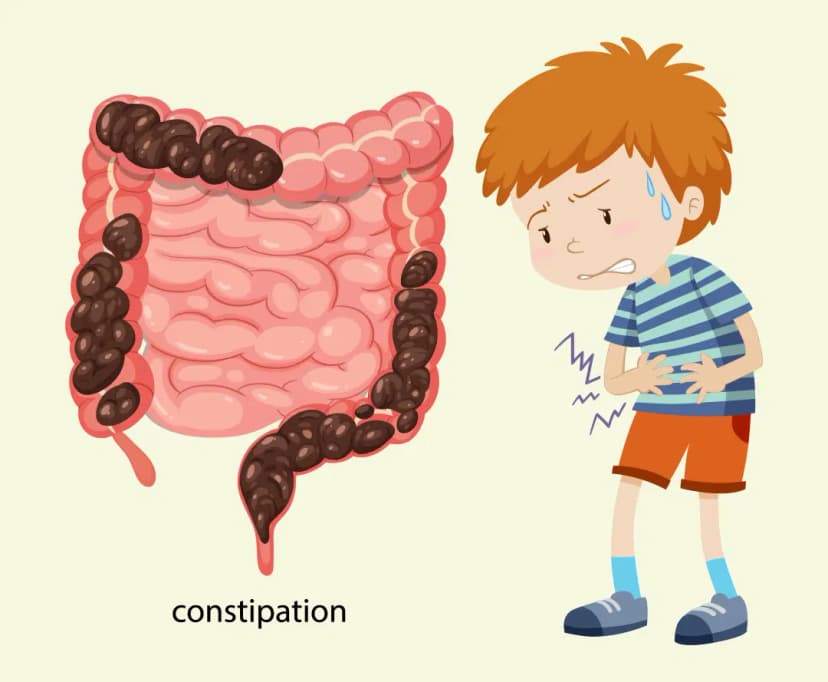 Constipation