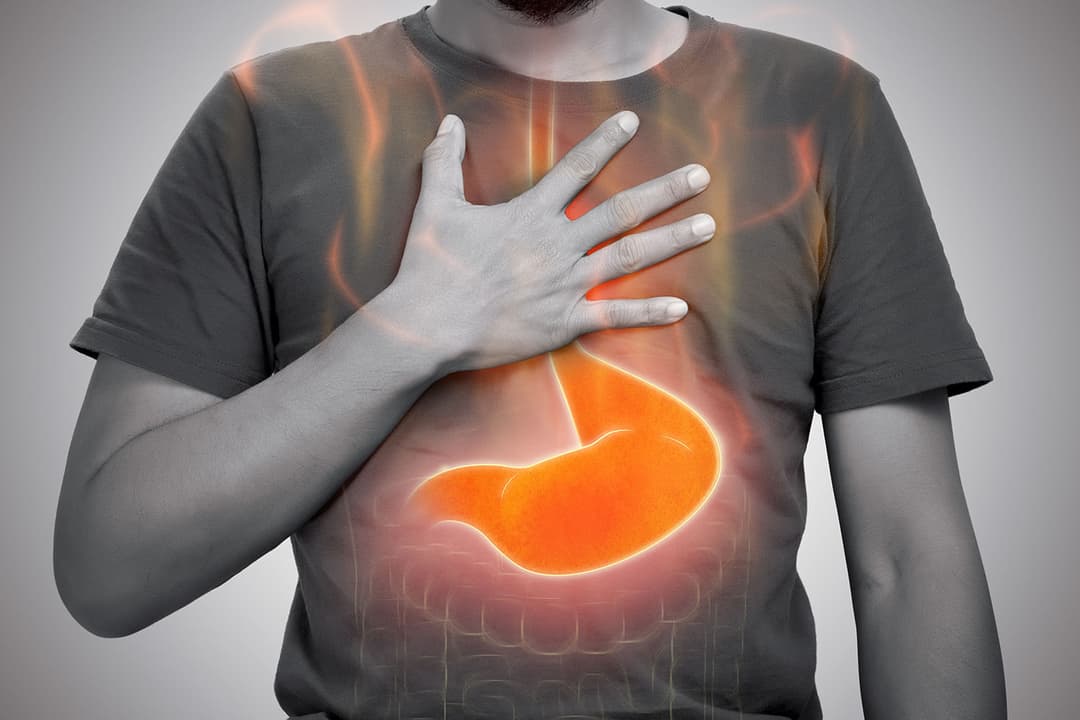 Gastritis