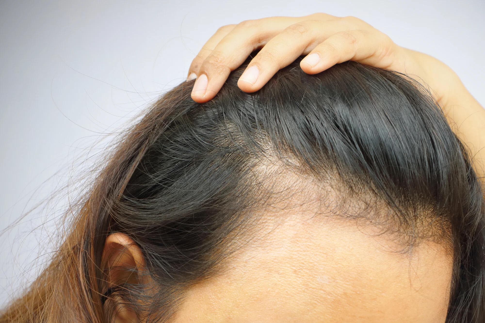 Visible Scalp