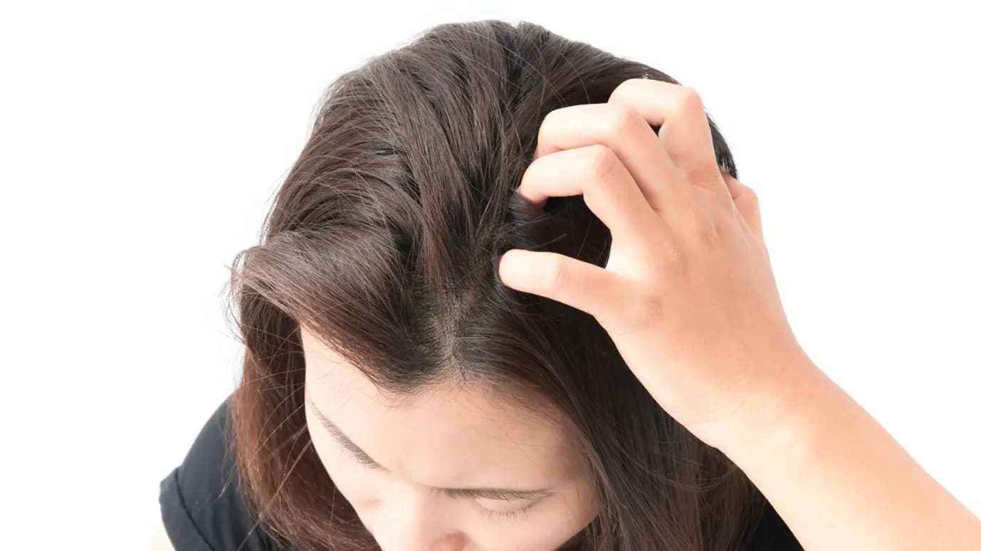 Itchy Scalp