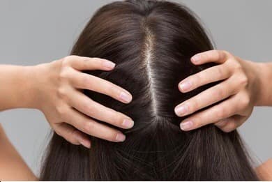 Scalp
