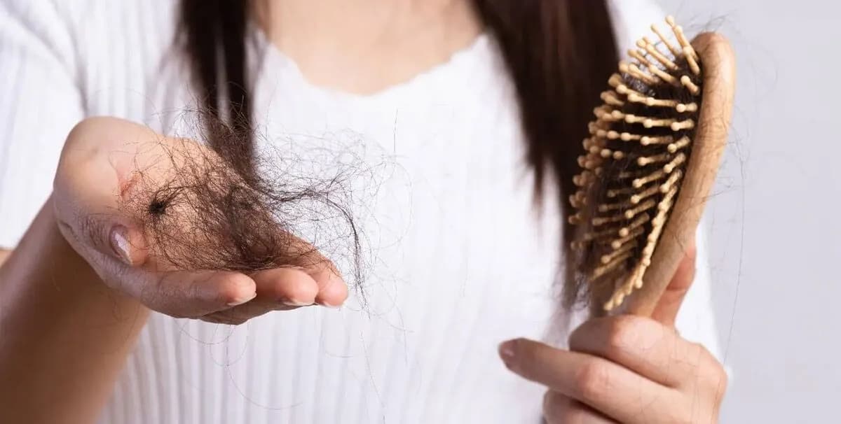 Hairfall