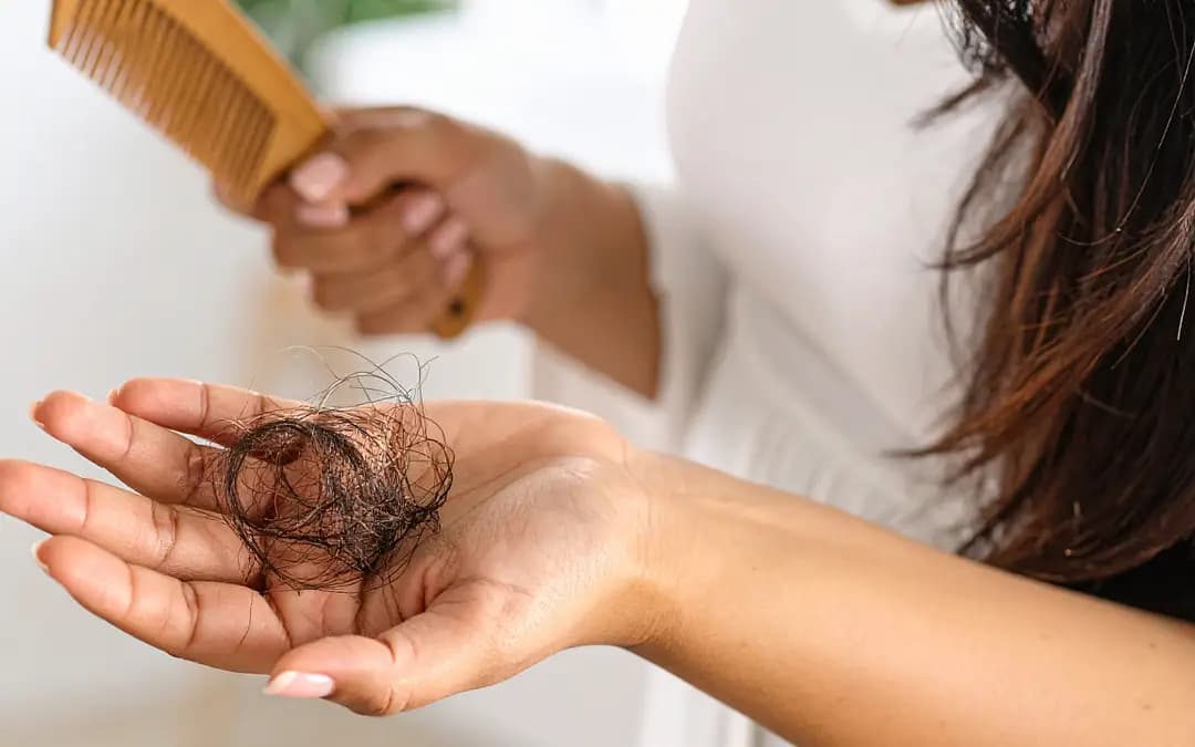 Hair Loss