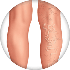 Visible Veins