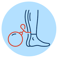 Leg Heaviness/Fatigue