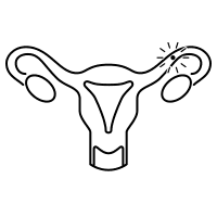 Ovulation