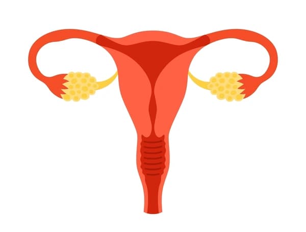 Uterine or Cervical