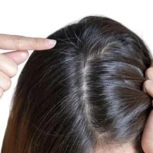 Premature Greying