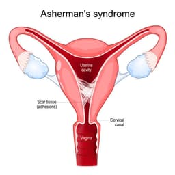 Adhesions or Scarring
