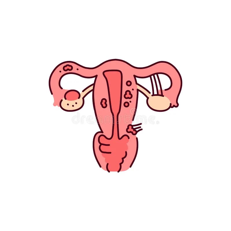 Endometriosis