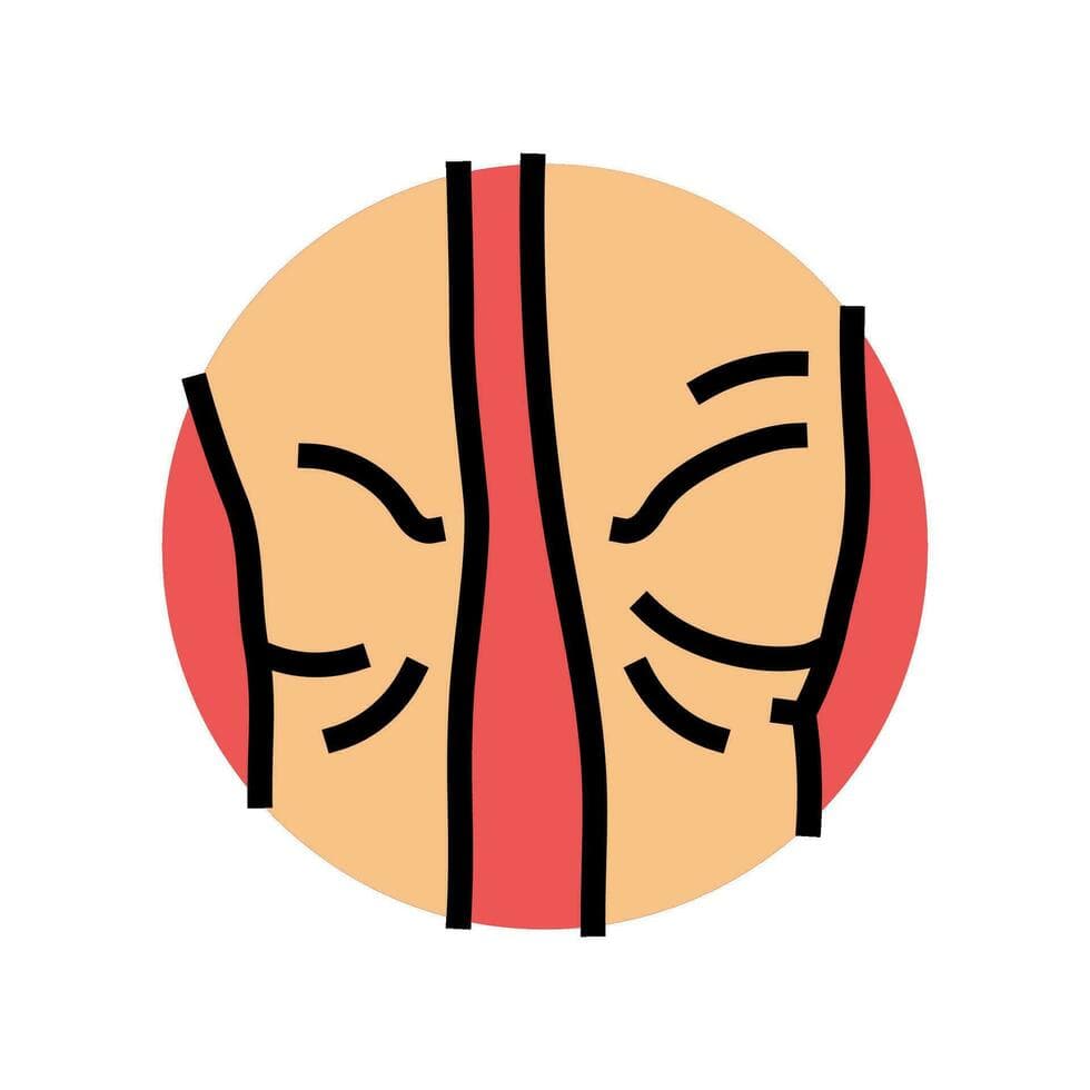 Joint Swelling