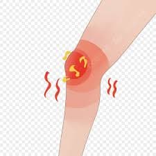 Joint Inflammation