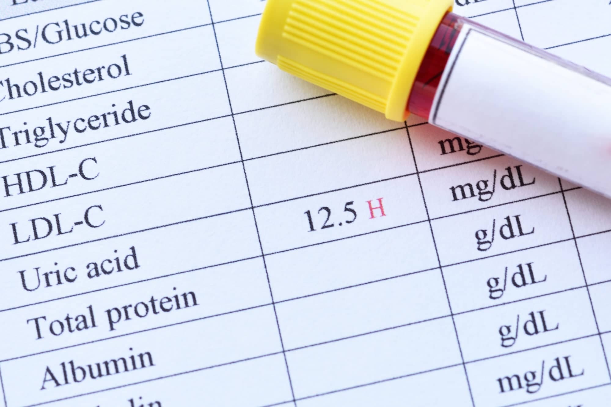 High Uric acid Levels