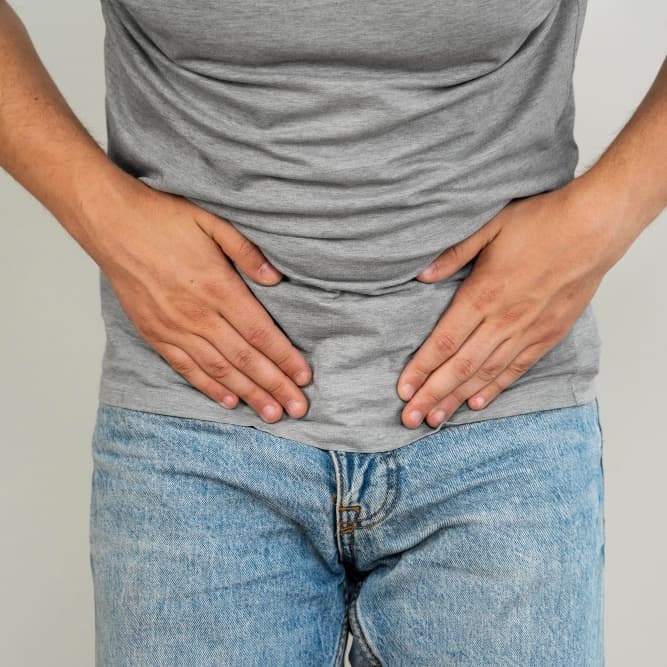 Varicocele