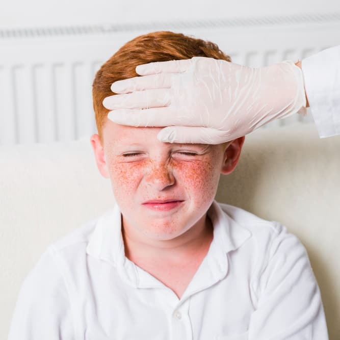 Eczema
