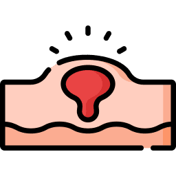 Lumps/Swelling