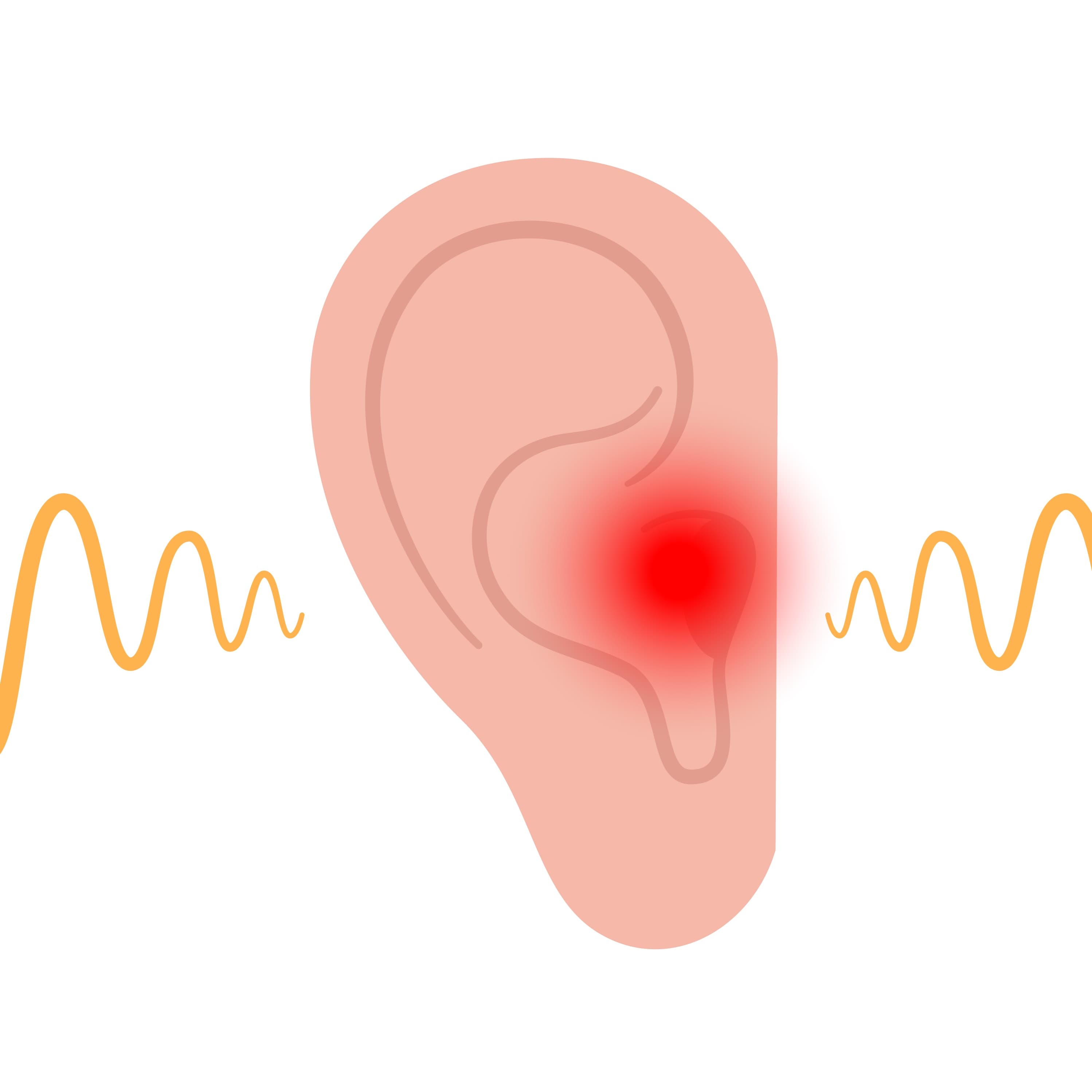 Tinnitus (Buzzing/Roaring Sounds)