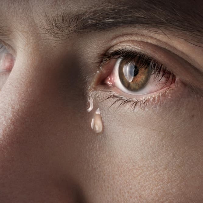 Watery Eyes