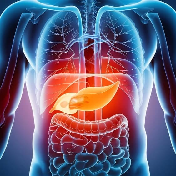 Pancreatitis