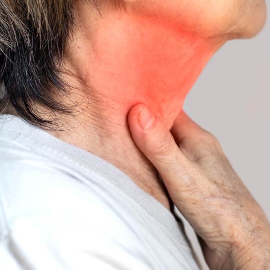 Pharyngitis
